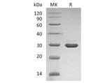 Recombinant Human β-NGF/NGFB Protein (with pro peptide)(Active)