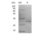 Recombinant Human Prolactin/PRL Protein 