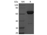 Recombinant Human PD-1/PDCD1 Protein (Fc Tag)(Active)