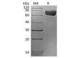 Recombinant Human PD-L2/CD273 Protein (mFc Tag)