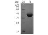 Recombinant Human PD-L1/B7-H1/CD274 Protein (His Tag)(Active)