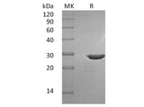 Recombinant Human BDNF Protein (with pro peptide)(Active)