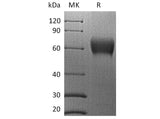 Recombinant Human B7-H5/Gi24/VSIR Protein (mFc Tag)