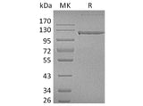 Recombinant Human CD31/PECAM1 Protein (Fc Tag)