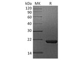 Recombinant Human Cyclophilin B/PPIB Protein (His Tag)