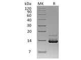 Recombinant Human Parathyroid Hormone/PTH Protein (His Tag)