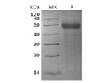 Recombinant Human TNFSF4/OX40L Protein (mFc Tag)