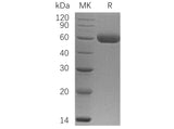 Recombinant Human Osteoprotegerin/TNFRSF11B Protein (His Tag)(Active) Purity >95%