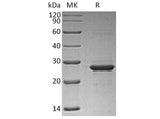 Recombinant Human Oncostatin M/OSM Protein (His Tag)(Active)