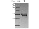 Recombinant Human Noggin/NOG Protein