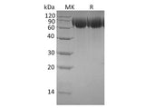 Recombinant Human TrkB/NTRK2 Protein (His Tag)(Active)