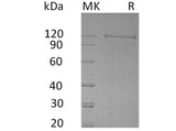 Recombinant Human NRCAM Protein (Fc Tag)