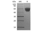 Recombinant Human NKG2D/CD314 Protein (Fc Tag)