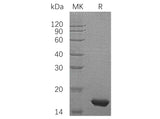 Recombinant Human PMP2/FABP8 Protein (His Tag)