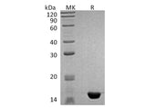 Recombinant Human MAP1LC3B Protein