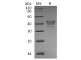 Recombinant Human METAP1 Protein