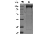 Recombinant Human VAP-1/AOC3 Protein (Fc Tag)