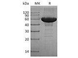 Recombinant Human MMP-3 Protein (His Tag)