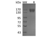 Recombinant Human c-KIT/CD117 Protein (His Tag)