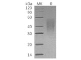 Recombinant Human LFA-3/CD58 Protein (His Tag) Expression Host HEK293 Cells