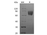 Recombinant Human LFA-3/CD58 Protein (Fc Tag)