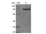 Recombinant Human LAG3/CD223 Protein (mFc Tag)