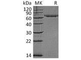 Recombinant Human LAG3/CD223 Protein (His Tag)(Active) Purity >95%