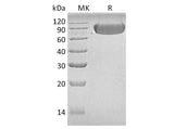 Recombinant Human LAG3/CD223 Protein (Fc Tag)(Active)