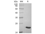 Recombinant Human ACP1/LMW-PTP Protein (His Tag)