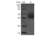 Recombinant Human CD47/IAP Protein (His Tag)(Active)