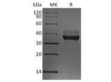 Recombinant Human LILRB4/CD85k/ILT3 Protein (His Tag)