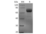 Recombinant Human LILRB4/CD85k/ILT3 Protein (aa 22-259, Fc Tag)