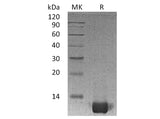 Recombinant Human IL-8/CXCL8 Protein (aa 23-99) 