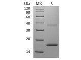 Recombinant Human Interleukin-7/IL-7 Protein (Active)