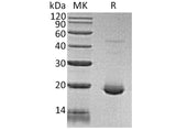 Recombinant Human IL-6/Interleukin-6 Protein (Active)