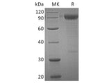 Recombinant Human IL3RA/CD123 Protein (Fc Tag)