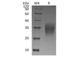 Recombinant Human Interleukin-22/IL-22 Protein