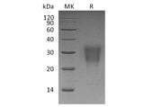 Recombinant Human Interleukin-22/IL-22 Protein (His Tag)