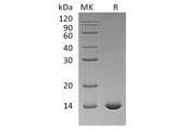 Recombinant Human Interleukin-2/IL-2 Protein (C145S)(Active)