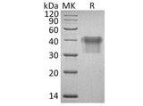 Recombinant Human IL2Ra/CD25 Protein (His Tag)