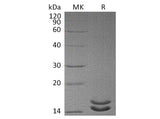 Recombinant Human Interleukin-2/IL-2 Protein (Mutant)(Active)