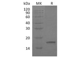 Recombinant Human Interleukin-18/IL-18 Protein