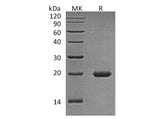 Recombinant Human Interleukin-17D/IL-17D Protein