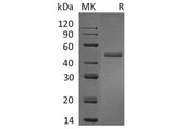 Recombinant Human IL17B/IL-17B Protein (Fc Tag)