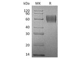 Recombinant Human IL17RA Protein (His Tag)