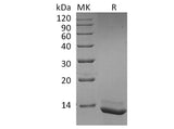 Recombinant Human Interleukin-15/IL-15 Protein (Active)