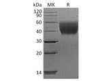 Recombinant Human IL10-RA/IL-10 Rα Protein (His Tag)