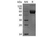 Recombinant Human IL-1R8/IL1RAPL1 Protein (aa 19-357, His Tag)