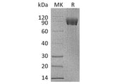 Recombinant Human IL-1R8/IL1RAPL1 Protein (Fc Tag)