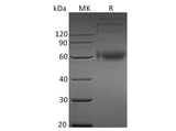 Recombinant Human IL-1RAcP/IL1R3 Protein (His Tag)